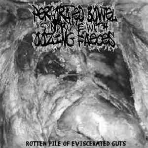 Perforated Bowel Syndrome With Oozing Faeces - Rotten Pile Of Eviscerated G ...