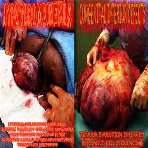 Congenital Interior Defects, Hypoprothrombinemia - Tumour Evolution Inferre ...