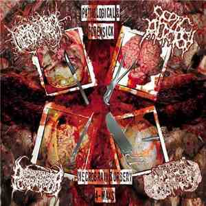 Hipermenorrea / Septic Autopsy / Putrefacto Hedor Cadaverico / Anatomical P ...