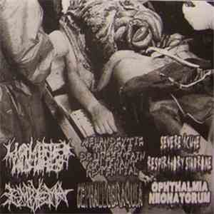 Liquified Insides / Melanocytic Tumors Of Uncertain Malignant Potential / S ...