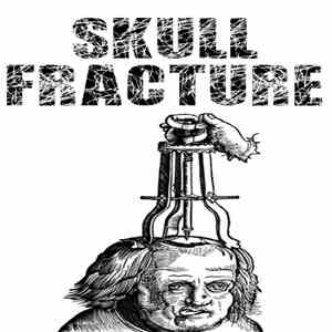 Skull Fracture - Skull Fracture
