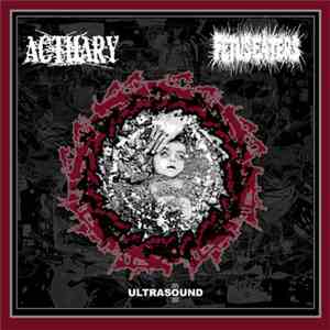 Fetus Eaters / Actuary - Ultrasound