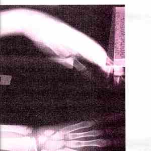 Climax Golden Twins - Soothing Sounds For Broken Bones