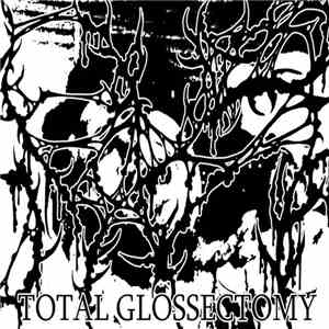 NX5 - Total Glossectomy