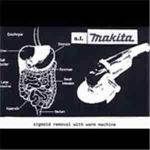 S.L. Makita - Sigmoid Removal With Warm Machine