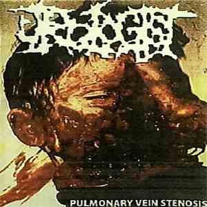 Urologist - Pulmonary Vein Stenosis