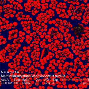 Nundata - Methicillin-Resistant Staphylococcus Aureus