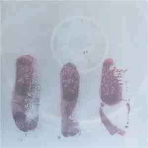 Carlos Villena - Anomalía
