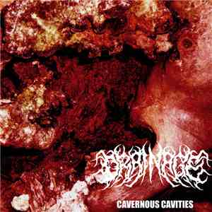 Drainage  - Cavernous Cavities