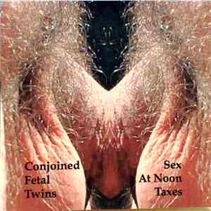 Conjoined Fetal Twins - Sex At Noon Taxes